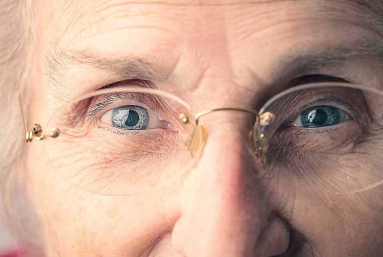 Что такое глаукома?